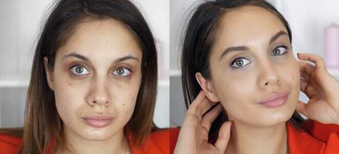 Как убрать синяки под глазами? 30 фото: как избавиться от темных кругов дома? Что хорошо помогает? Крем, отбеливание, народные или другие средства